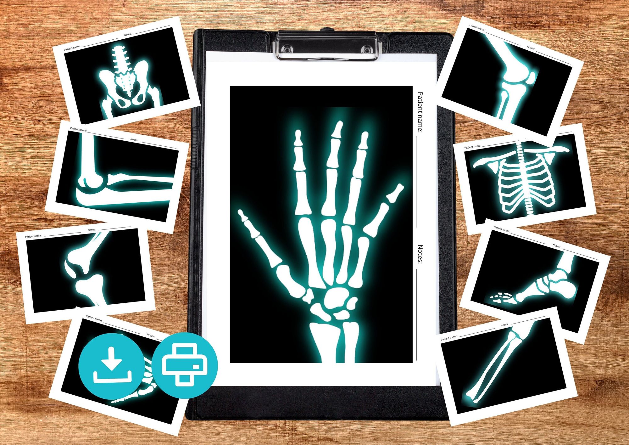 Printable X-rays for Kids. Pretend Play Kids X-ray Activity for ...